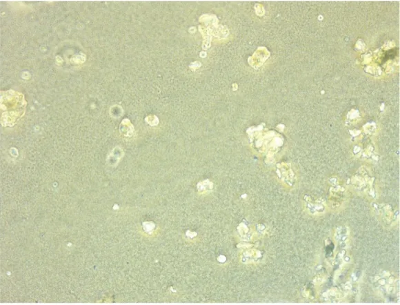 A light-microscope view of amorphous crystalline particles, with no hyphae or spores in sight.